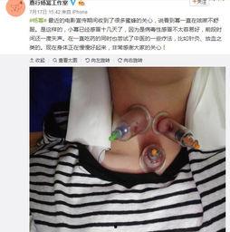 爱拔罐的明星,揭秘爱拔罐的明星养生之道”